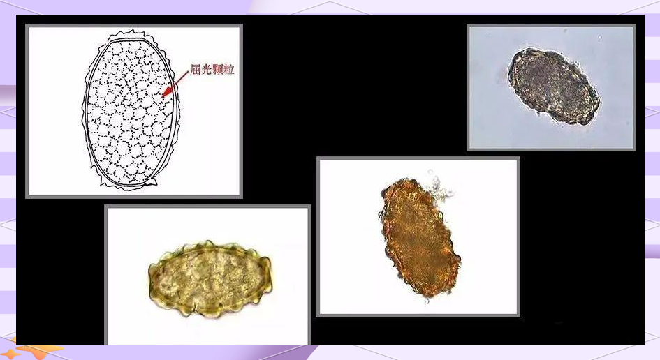 娜娜nana二郎腿 有助于改善下肢血液循环