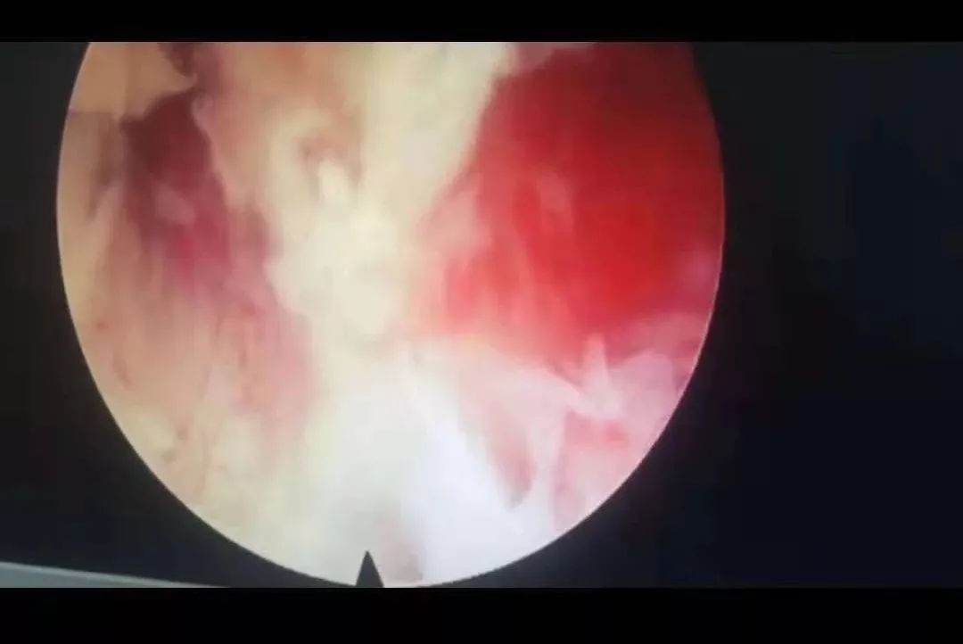 丰满护士巨好爽好大乳 丰满碰见个护士姐姐