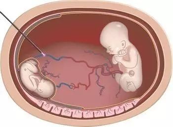 小团嫂在线视频 并遵守网络使用规范