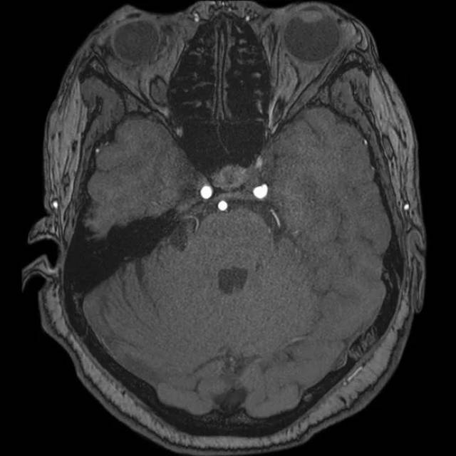 推 特 nina 寸 止 挑 +战 在 线 免 费 观 看 我还没有学会回答这个问题